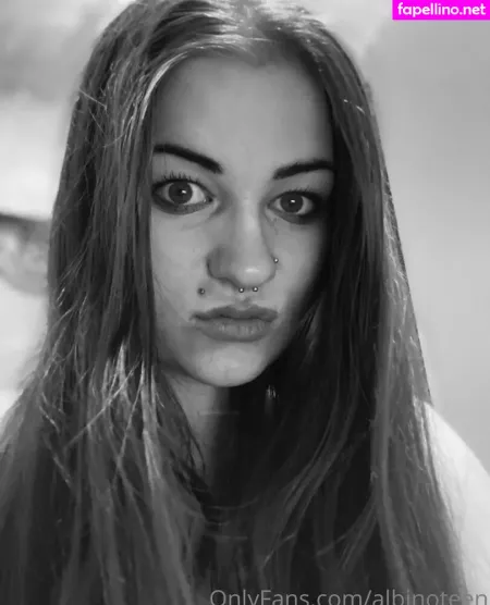 Albinoteen OnlyFans Thumbnail #4AfwzYoJhG