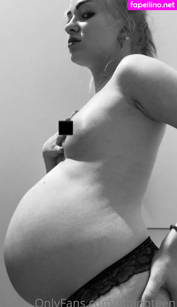 albinoteen Nude Leaked OnlyFans Photo #7AucOrCzoF