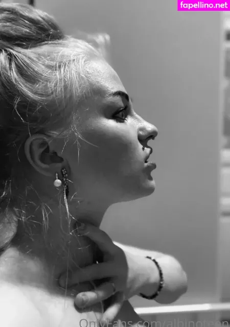 Albinoteen OnlyFans Thumbnail #EJwdt4EG7I