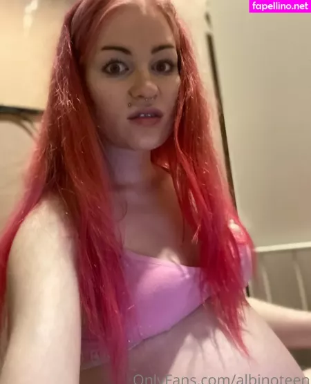 Albinoteen OnlyFans Thumbnail #GdCYCPyq8e