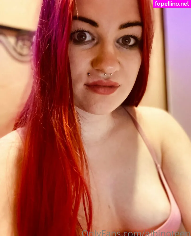 albinoteen Nude Leaked OnlyFans Photo #OfhAz2OuTV