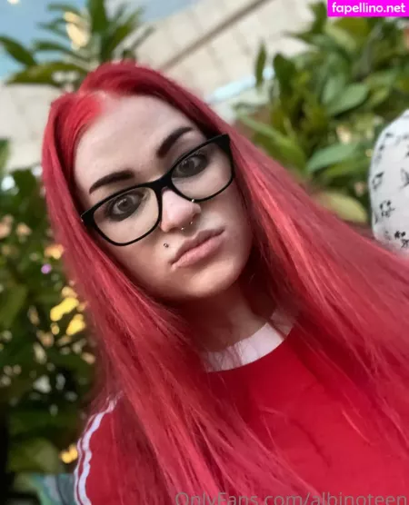 Albinoteen OnlyFans Thumbnail #Pp44ZLsZoc