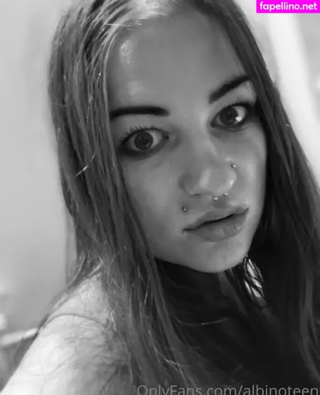 Albinoteen OnlyFans Thumbnail #wp5z3SGqON