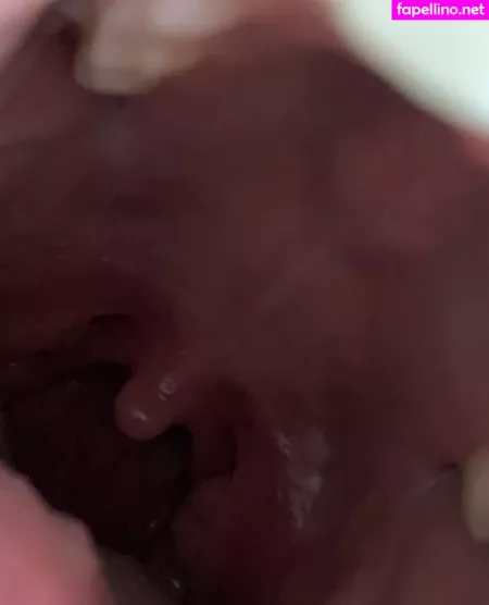 Aliceeats OnlyFans Thumbnail #YmHpySwTLo