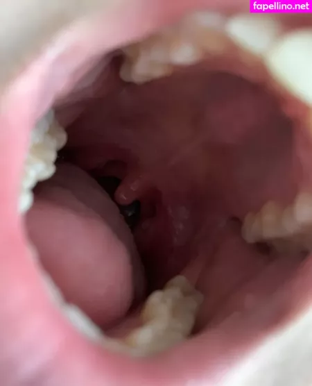 Aliceeats OnlyFans Thumbnail #lvvFWInMUl