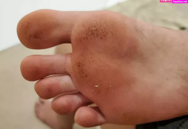 Alicefrenchfeet OnlyFans Thumbnail #JZKMkjbltK