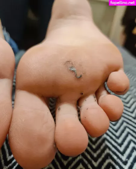 Alicefrenchfeet OnlyFans Thumbnail #a7K7WzzuML