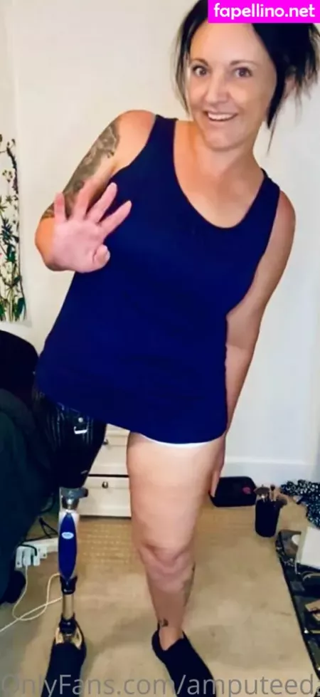 Amputeedarling OnlyFans Thumbnail #WkqkcOKGYf