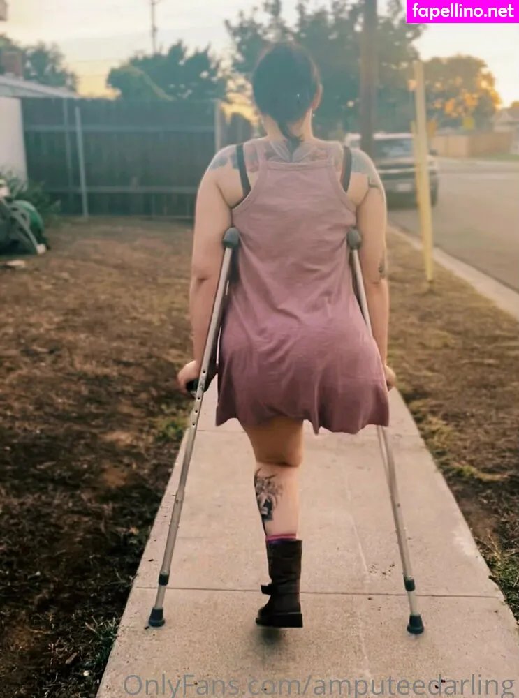 amputeedarling, amymoormann Nude Leaked OnlyFans Photo #YTSOlqShHM