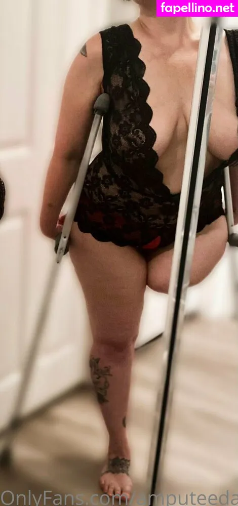 amputeedarling, amymoormann Nude Leaked OnlyFans Photo #lgJA9yRRRP