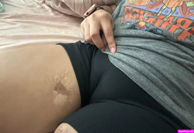 Amputeefreak Main Profile Photo