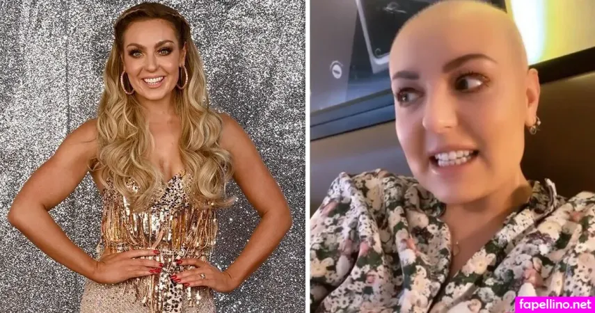 Amy Dowden OnlyFans Thumbnail #UYqL1MKAiX