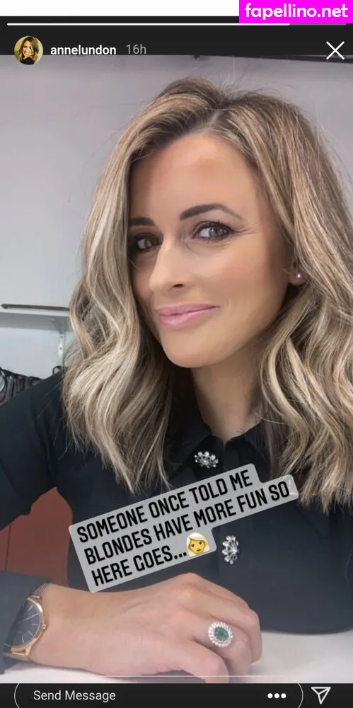 McAlpine, lundon.anne Nude Leaked OnlyFans Photo #lBedNytVKy