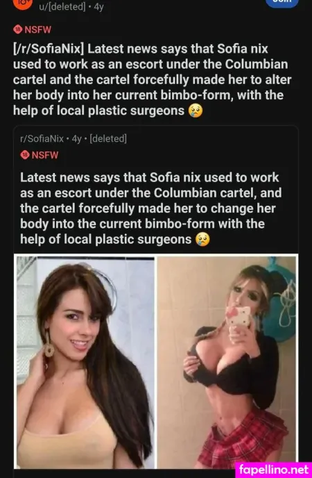 Before And After Pornstar Boobjobs OnlyFans Thumbnail #qrBoxOy9XF