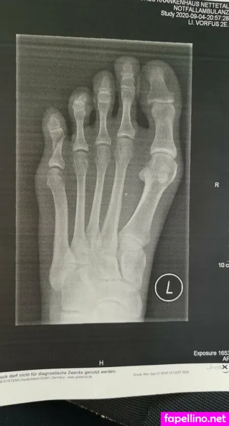 Birki Heaven OnlyFans Thumbnail #hEkNg2PGXk