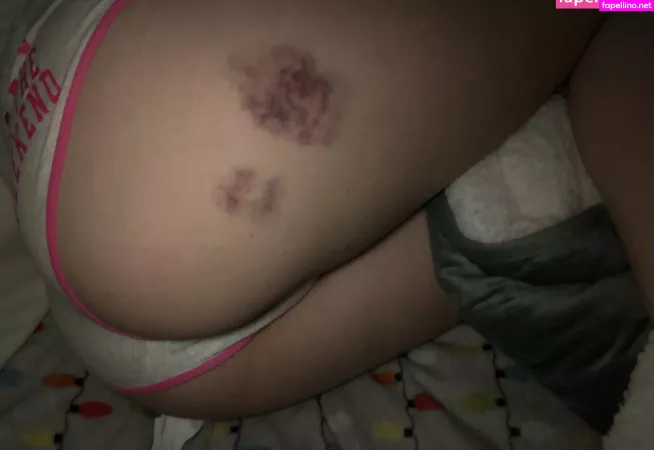 Bleedingbubblegum OnlyFans Thumbnail #V9J9h7MlEx