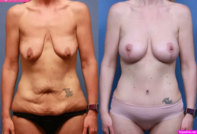 Boston Mom OnlyFans Thumbnail #qgweXlPsu7