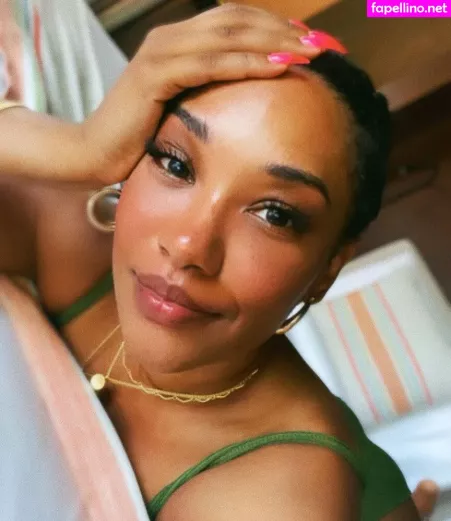Candice Patton OnlyFans Thumbnail #WaCZJqhKkn
