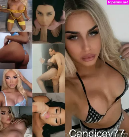 Candicev77 OnlyFans Thumbnail #D57BoZyOLO