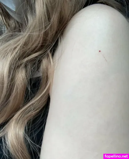 Chrissycantwalk OnlyFans Thumbnail #GulcgriCV7