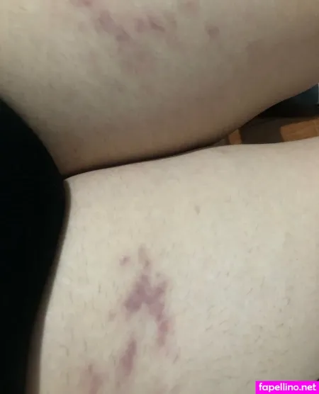 Dasshitee OnlyFans Thumbnail #gFfW2zTd6Z