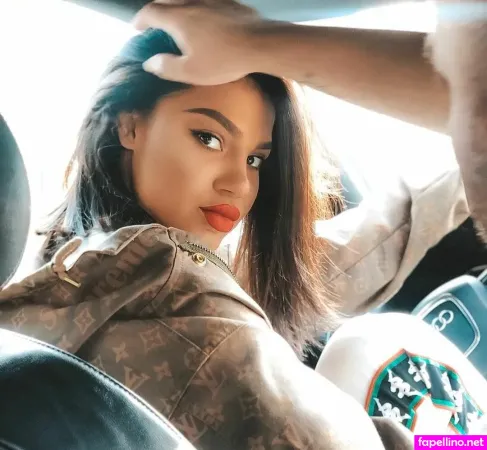 Dhurata Dora OnlyFans Thumbnail #v4nlAV8FsZ