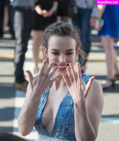 Elizabeth Henstridge OnlyFans Thumbnail #9xuoUYuMOr