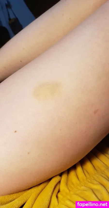 Ew Gross OnlyFans Thumbnail #80MckCbmWq