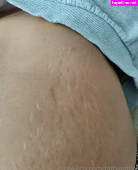 Fattypotchi OnlyFans Thumbnail #rPn5f4weih