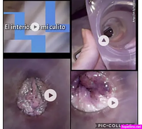 Fenix10 OnlyFans Thumbnail #xmB6pLA9GW