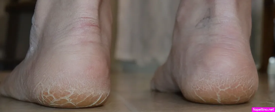 Flirtyf33t94 OnlyFans Thumbnail #SYYwtCch7C