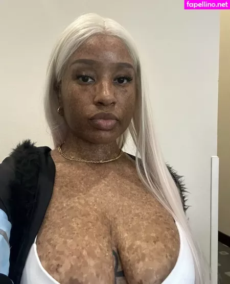 Freckledn OnlyFans Thumbnail #AQhSNOwY3A