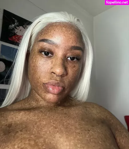 Freckledn OnlyFans Thumbnail #DSxL9XMI0j