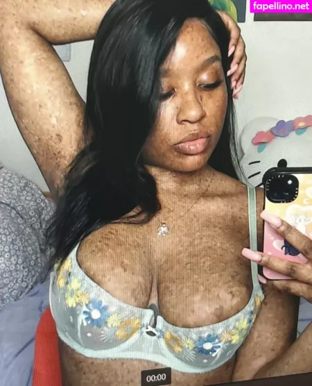 Freckledn OnlyFans Thumbnail #S3yuu5Sp2n