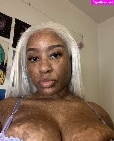 Freckledn OnlyFans Thumbnail #cEc6vSZeUN