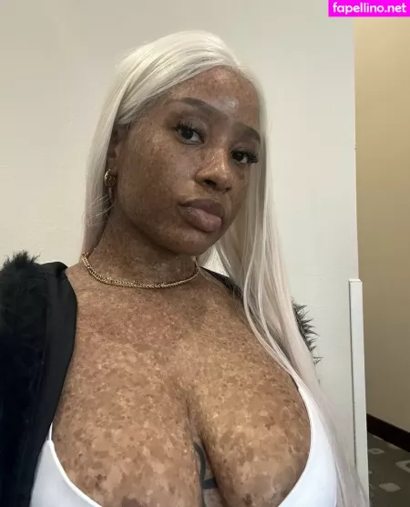 Freckledn OnlyFans Thumbnail #kPTlhZLmi9