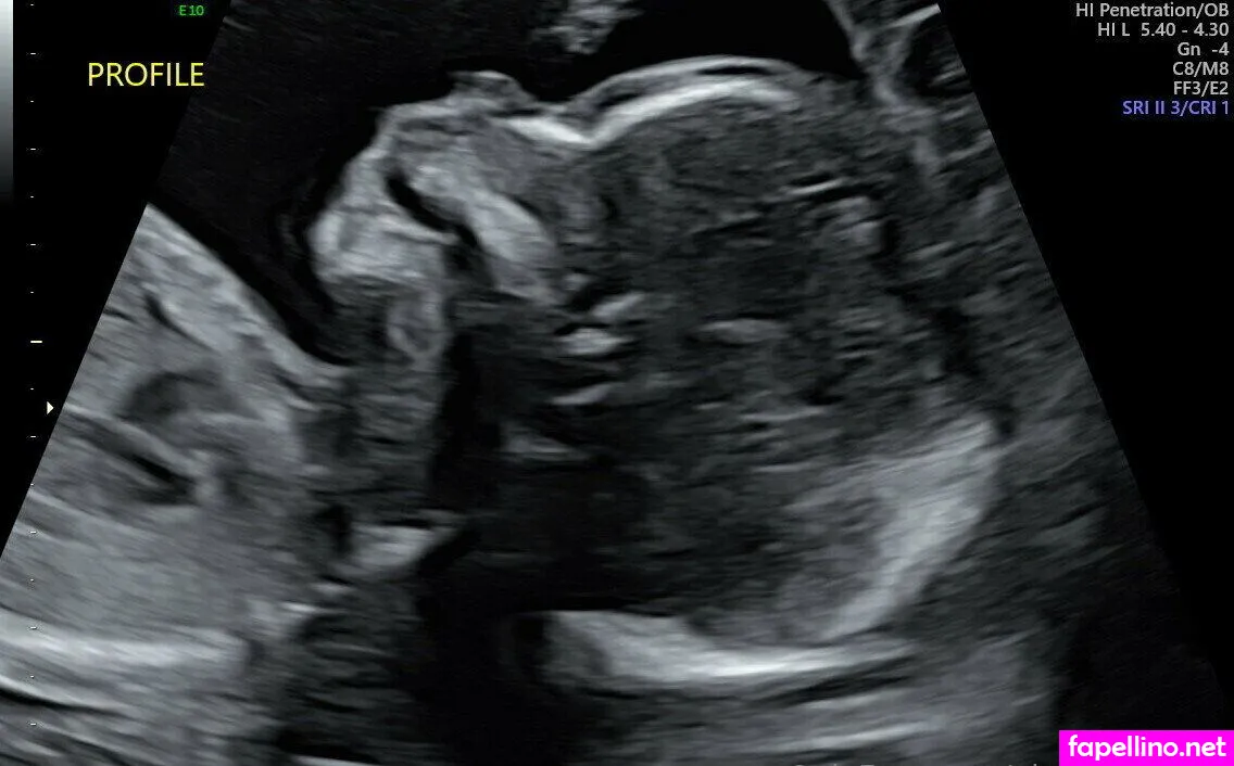 gigglebox333 Nude Leaked OnlyFans Photo #8Zh33M7Xkx