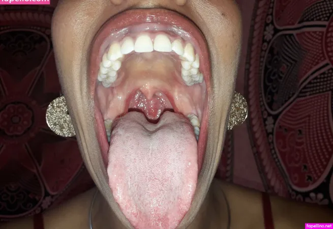 Goldenlace 5 Main Profile Photo