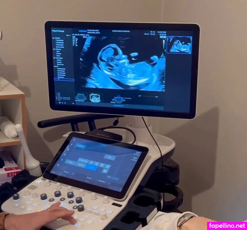 Greta Orsingher Nude Leaked OnlyFans Photo #MmzAv23TNW