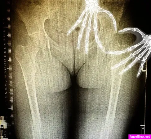 Grungifungifree OnlyFans Thumbnail #KYFx18y8oj