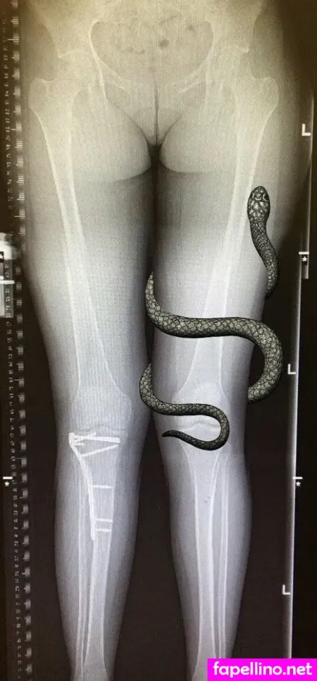 Grungifungifree OnlyFans Thumbnail #el9MuKHpq0