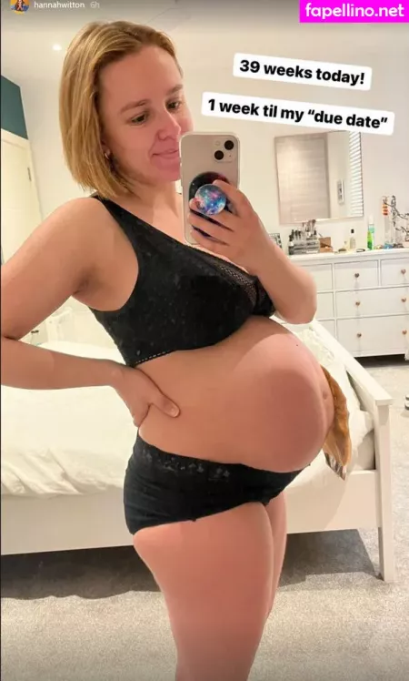 Hannah Witton OnlyFans Thumbnail #D4kXxSFRoU
