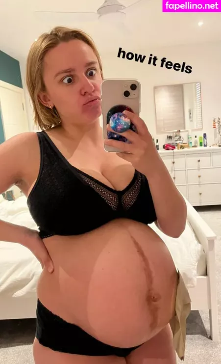 Hannah Witton OnlyFans Thumbnail #RD4G9AA9oX