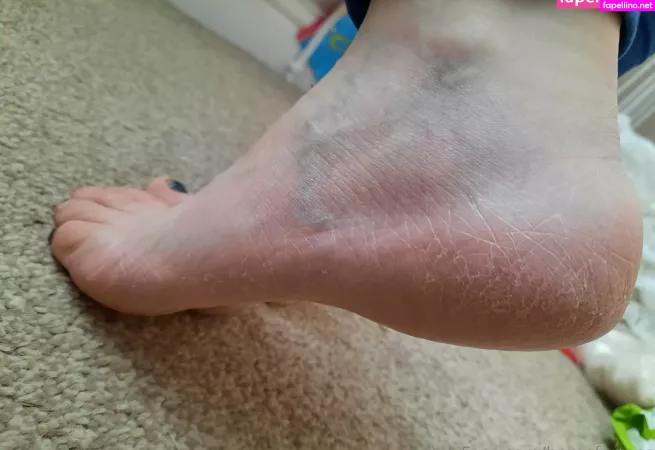 Homefortoes OnlyFans Thumbnail #1oUoKlESxZ