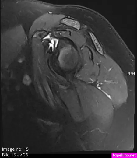 Impossible Kakan OnlyFans Thumbnail #I46A4uBf6i