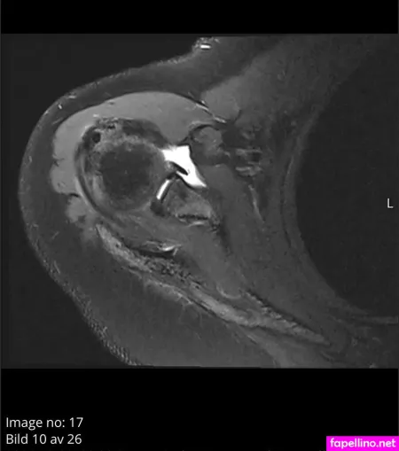 Impossible Kakan OnlyFans Thumbnail #KYbOvCa0CG