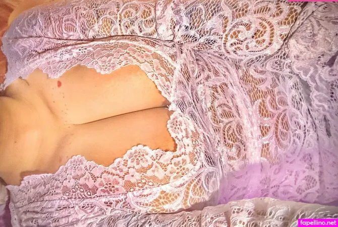 Itsaestephtics OnlyFans Thumbnail #k00N9d4Eq4