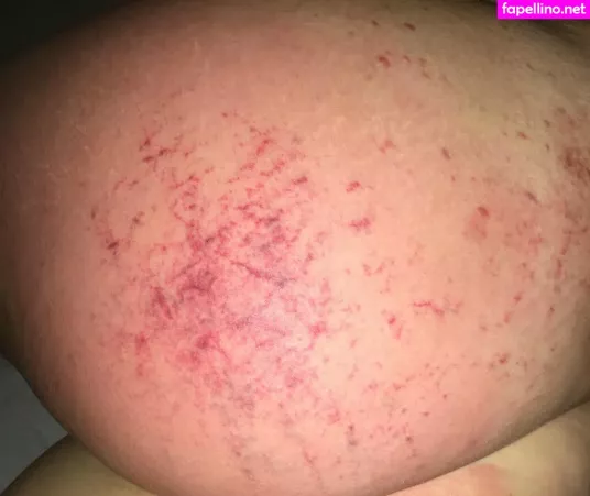 Itsdollyxxx OnlyFans Thumbnail #Zu1hEGA4hM