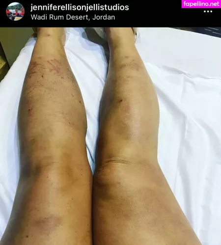 Jennifer Ellison OnlyFans Thumbnail #Z8c4k8UCyN