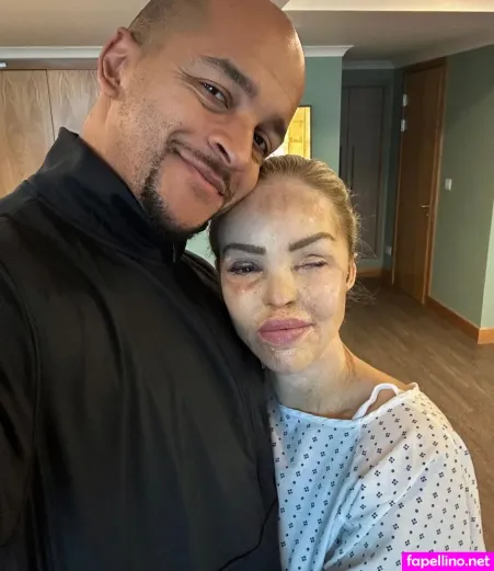 Katie Piper OnlyFans Thumbnail #mOcwN5lMEz